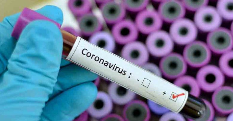 تم-اختبار-لقاح-فيروس-كورونا-لأول-مرة-،-وستستغرق-النتائج-وقتًا-طويلاً